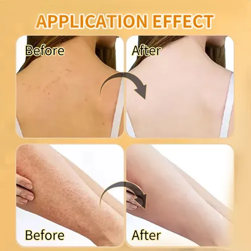 ‘n– 2 Paquetes De Exfoliante Corporal Con Cúrcuma, Limpiador
