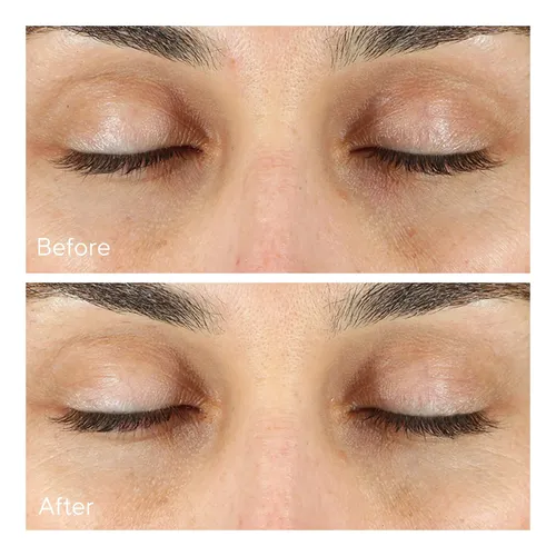 Corrector De Ojeras Murad Vita-c Eyes