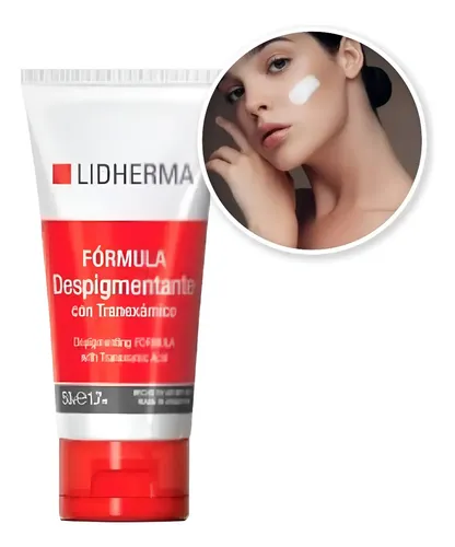 Crema Blanqueadora Fórmula Despigmentante Manchas Lidherma