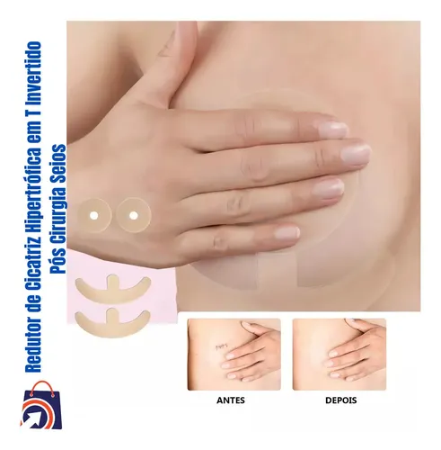 Parche Cicatriz Mama Mastopexia Mastoplastia 4u Anclas