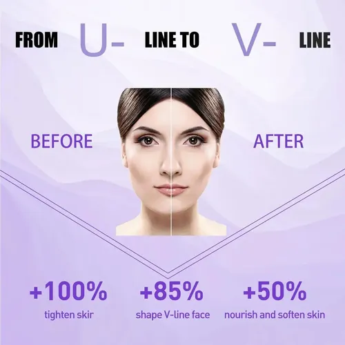 Crema Hidratante Antipapada Facial Menton Cara Tipode Piel Todo Tipo De Piel Día/noche