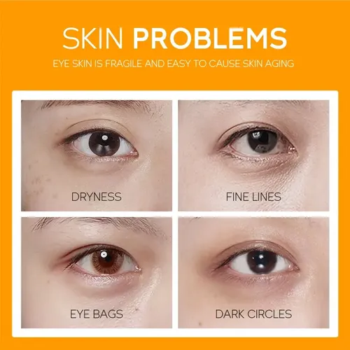 Crema Blanqueadora Para Ojos Fenyi Con Vitamina C Que Suaviz