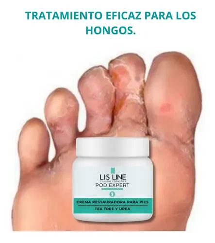 Removedor De Callosidades 500 Ml Y Crema Restauradora 250 Ml