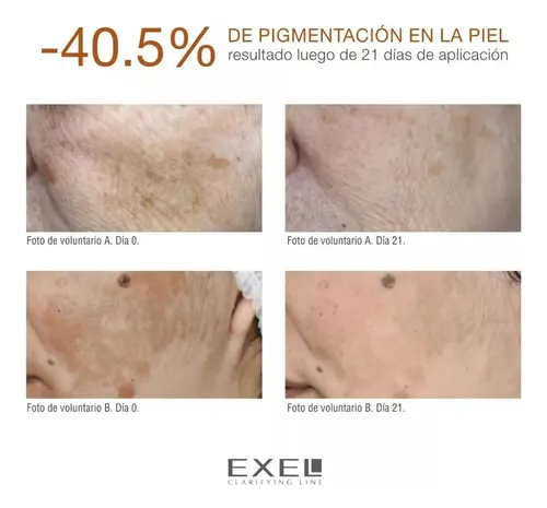 Exel Crema Clarificante Liposomas Por 30ml Aclara Manchas.