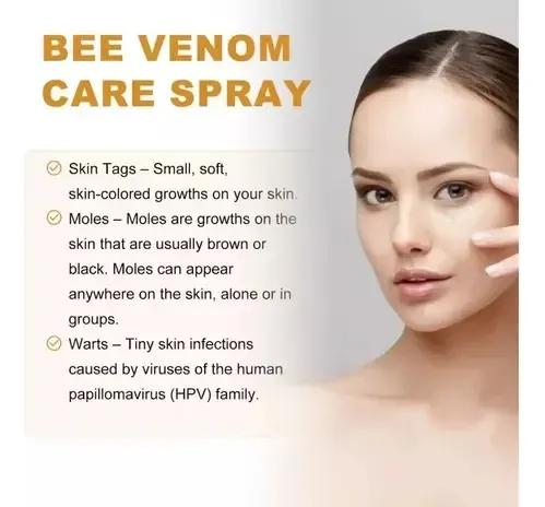 Aerosol De Verruga Venenosa De Abeja (1piece) .