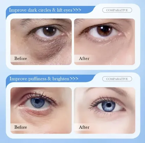 Crema Contorno De Ojos Sadoer 8d Ácido Hialurónico Y Retinol
