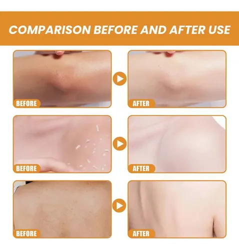 Gel Exfoliante Facial Aclarante Limpieza Profunda 50g