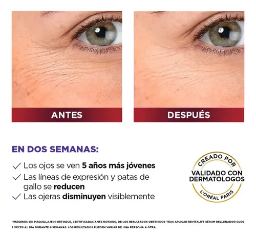 Sérum para Ojos L’Oréal Paris Revitalift Ácido Hialurónico x 20 ml