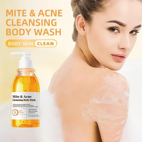 M/h Gel Corporal Limpiador Antiacné Y Ácaros 250ml Control