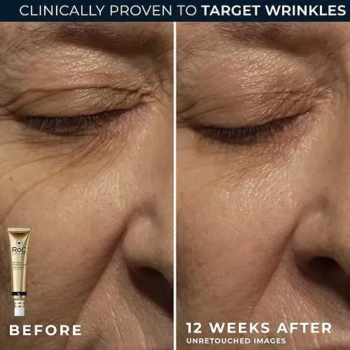 Roc Retinol Correxion Crema Para Debajo De Los Ojos Ojeras