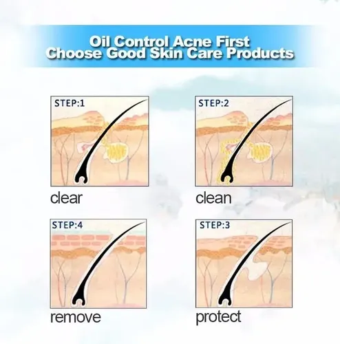 Limpiador Facial Bioaqua Elimina Acné Piel Grasosa Aloe Vera Tipo De Piel Todo Tipo De Piel