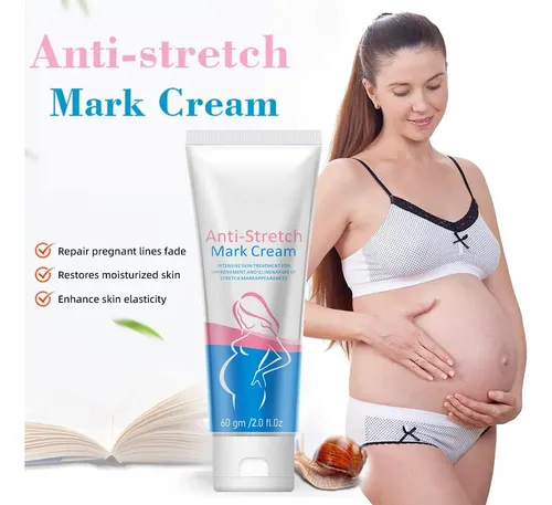 Crema De Estrías For Mujer, 2 Unidades De Crema Reparadora .