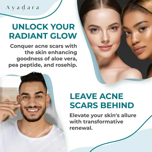 Crema Cicatrices Acné Ayadara Humectante Rostro Cuerpo