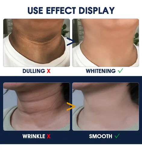 Crema Antienvejecimiento Para Tonificar Y Levantar El Cuello