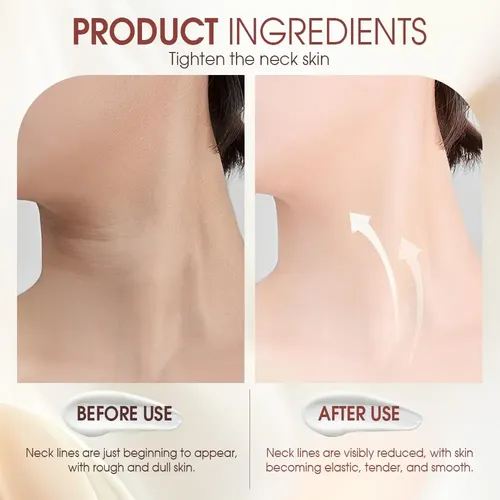 Crema Reafirmante Para Cuello Amtf Ah-8 Para Pieles Arrugadas. ,;