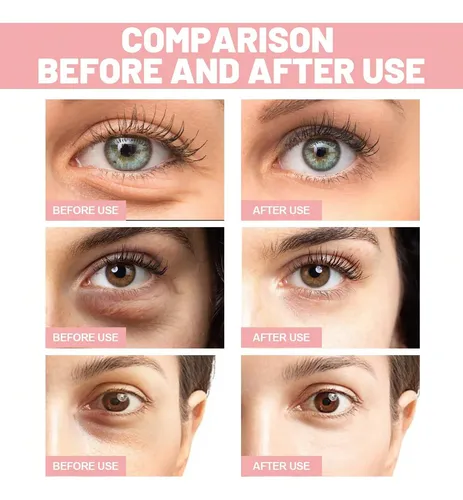Rose Moisturizing Eye Mask To Reduce Wrinkles Around The Eye