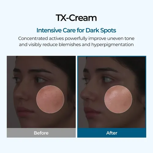 Crema Ácido Tranexámico 50 Ml Todo Tipo Piel