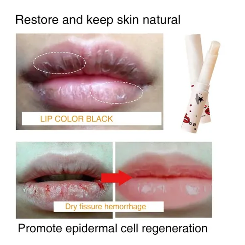 L/x Bálsamo Labial Para Labios Oscuros, Arrugas Labiales Y