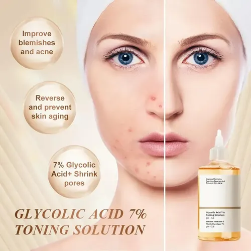 Ss Tónico Exfoliante Sdadcs Con 7% De Ácido Glicólico –