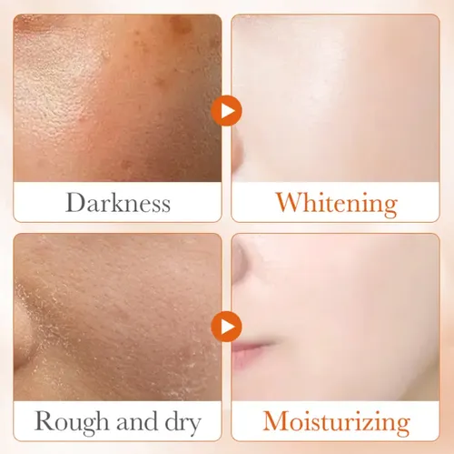 Serum Suero Facial Vitamina C 5x Niacinamida Blanqueadora Todo Tipo De Piel Día/noche