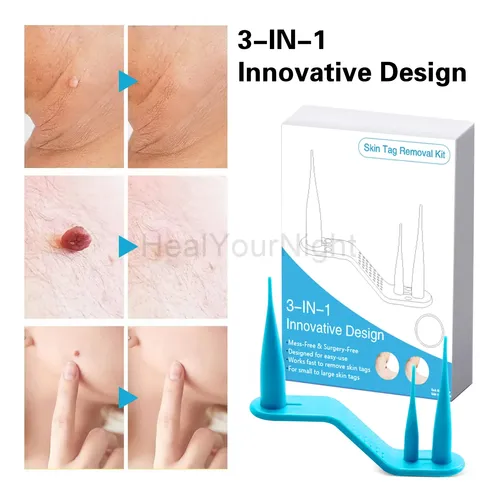Kit De Depilación Automática 3 En 1 Ac Tag Painless Mole Kmn