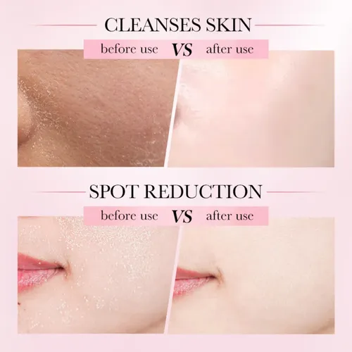 Limpiador Mousse Facial 4 En 1 Multiefecto 150ml Sadoer