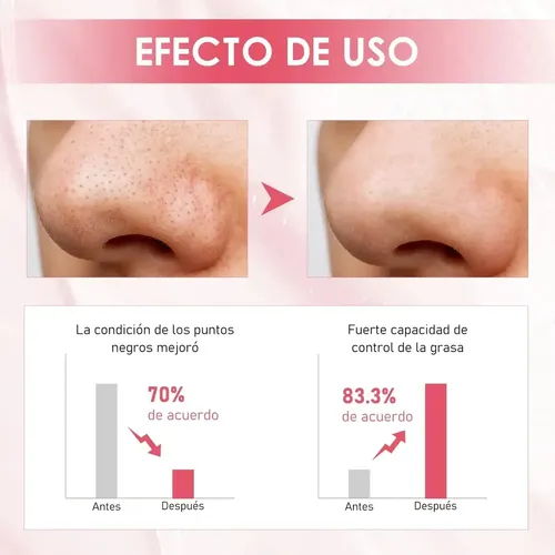 1 Mascarilla De Arcilla Poromizante De Acción Rápida, Zxc