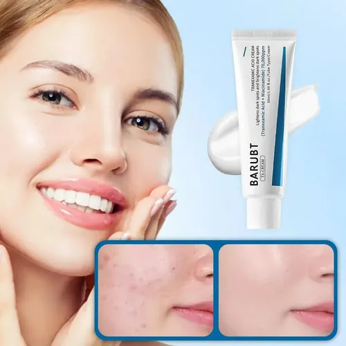 Zy Crema Fb Para Manchas Con Ácido Tranexámico 1 Pieza.. A+