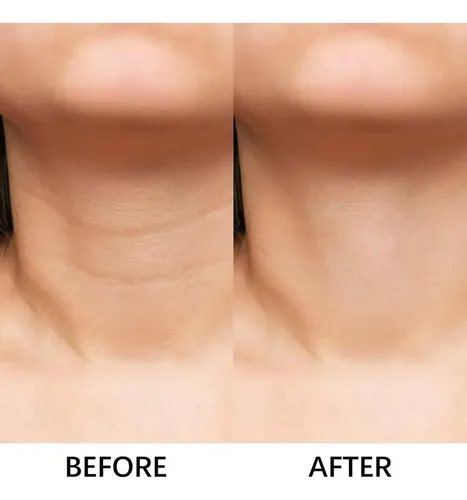 M* – Crema For El Cuello, Crema Reafirmante Antiedad *xl