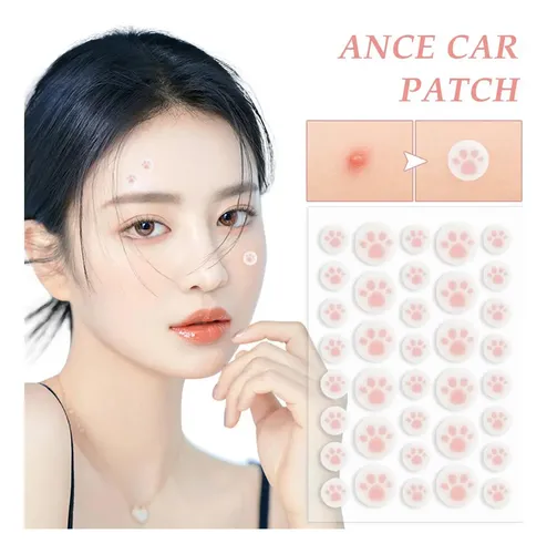 36 Unidades Cute Patch Cat Colorful Paw Pin Acne Ii