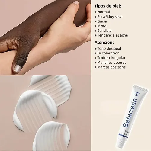 Creme Clareador, Creme De Hidroclorotiazida De Betametasona.
