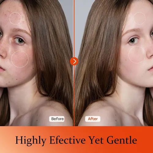 Suero Facial con Vitamina C Tinclen para Todo Tipo de Piel