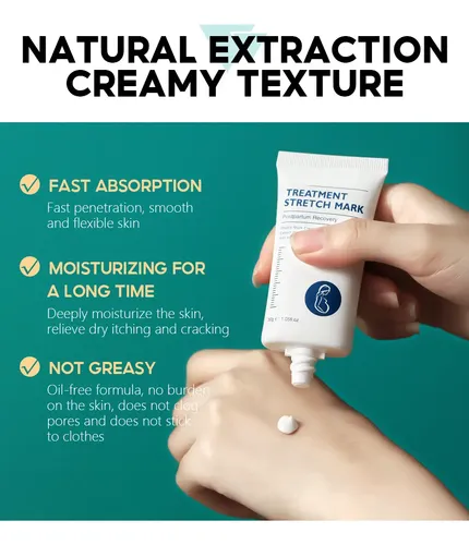 Crema Para Estrías Eliminar Las Estrías Del Embarazo