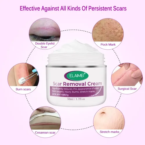 Crema Para Eliminar Cicatrices, Aliviar Estrías Y Quemar