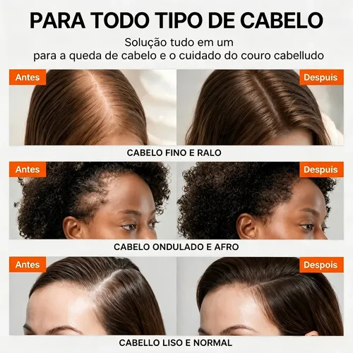 Sérum Crecimiento Capilar Lilyeve Con Aplicador
