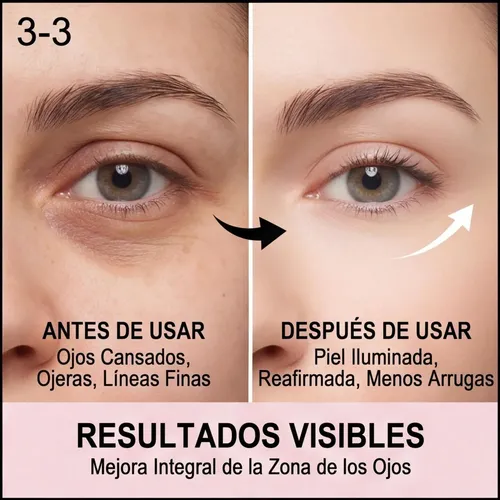 Crema De Ojos Masaje Eléctrico Polipéptido Anti Ojeras Jaysu Día/noche
