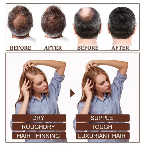 #aceite Esencial De Aceite De Ricino Eelhoe Para Cabello Den