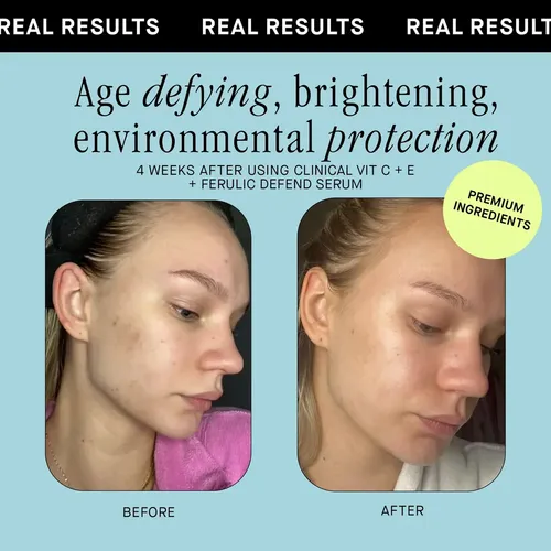 Sérum Brandefy Defend Antiedad con Vitamina C y Ácido Ferúlico