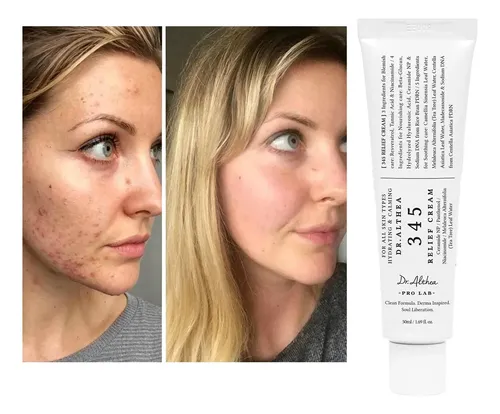 Crema Diaria Para El Alivio Facial, Cuidado Calmante Y Para  Todo Tipo De Piel Día/noche