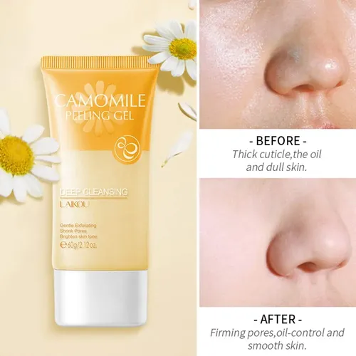 Gel Exfoliante Facial De Manzanilla Ubeu, Limpieza Profunda