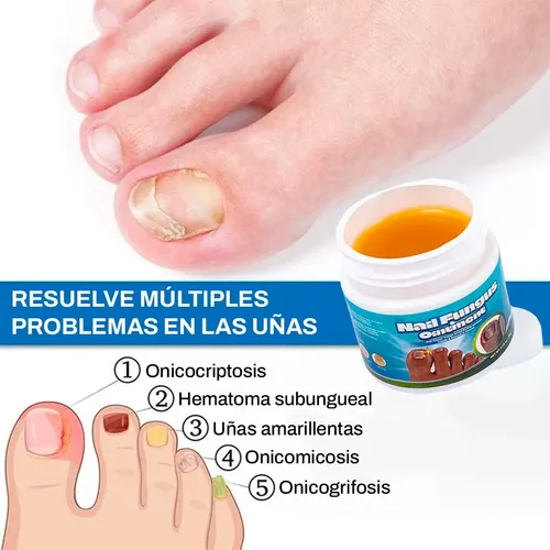 Crema Reparadora Uñas Antihongos Bálsamo Reparador