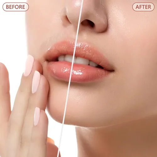 Eviey Depiladora Facial Eléctrica Led Oro Rosa