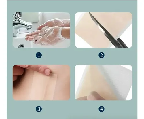 Rollo de Parche de Silicona para Eliminar Cicatrices y Queloides 1.5Mts