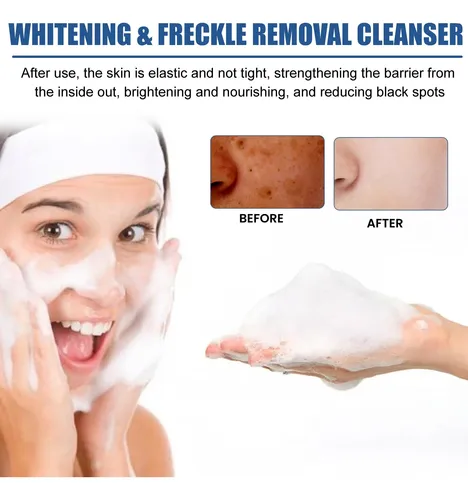Pmlimpiador Facial Hidratante Suave: Gel De Limpieza Facial@