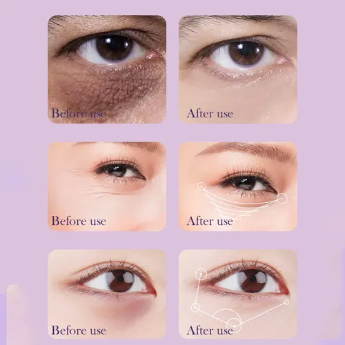 Sérum Para Ojos Con Cafeína Mate 15 Ml
