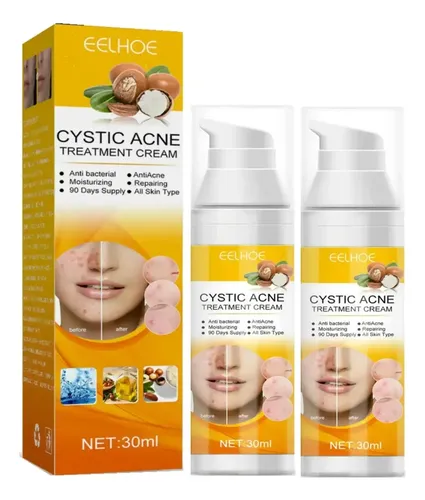 2×crema Para Tratar El Acné Combate El Acné Quístico Hormon Todo Tipo De Piel