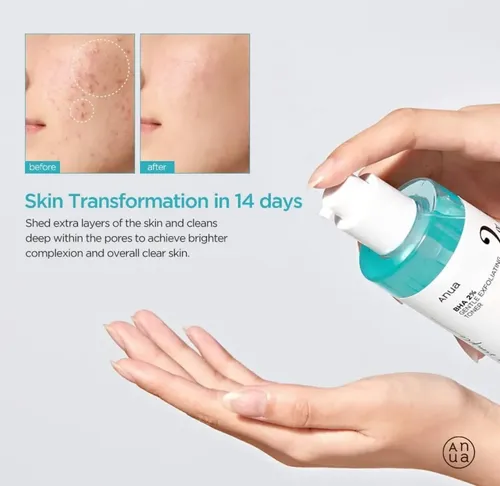 Anua Tonico Exfolian Bha 2% Gentle Exfoliating Toner 150 Ml