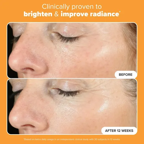 Cc Sérum Facial Vitamina C 15% Con Ácido Ferúlico