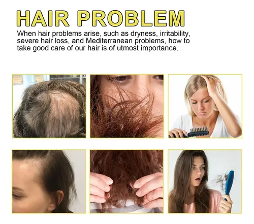 Aceite Capilar Hoegoa Para Cabello Seco Y Encrespado