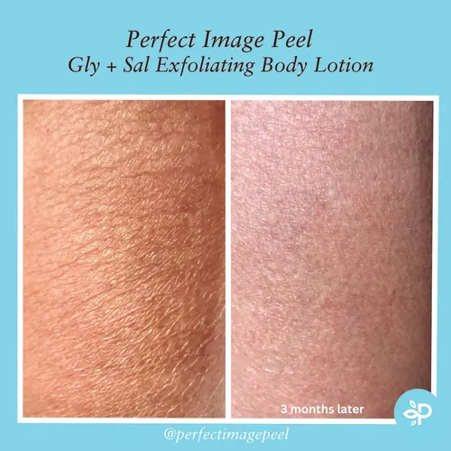 Loción Corporal Exfoliante Perfect Image Gly + Sal 240 Ml